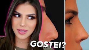 Gostei da minha RINOPLASTIA? | Fernanda Petrizi