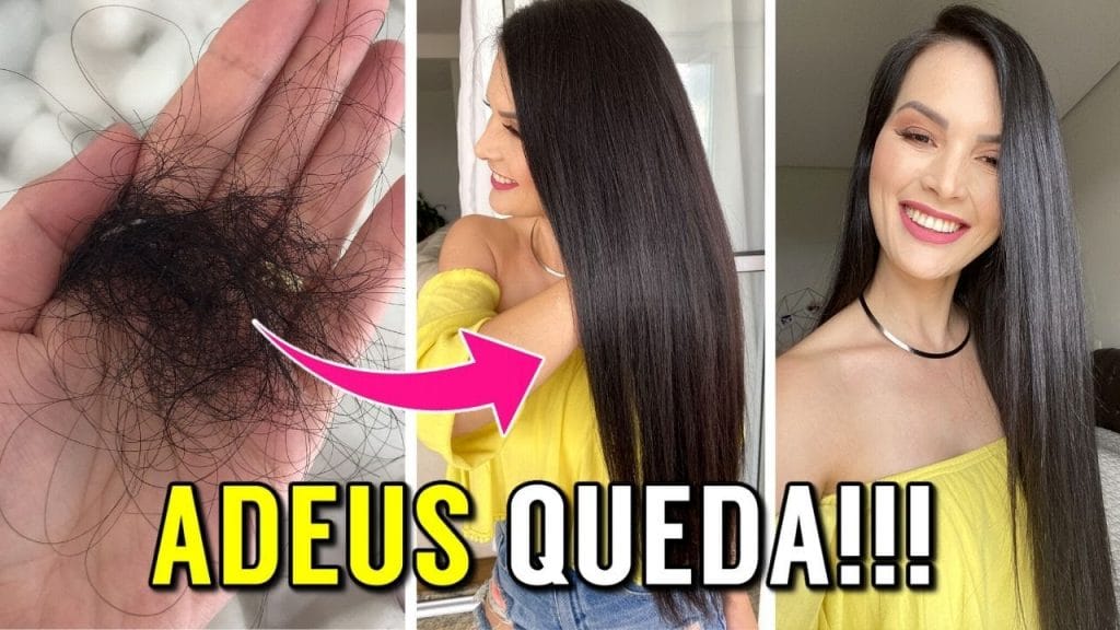 Queda Capilar: O Que Fazer Para O Cabelo Parar De Cair? Porque Meu ...