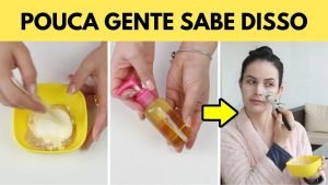 Leia mais sobre o artigo Use Isso Uma Vez: Clareia Manchas na Pele de Foliculite, Espinhas e do Sol por Julia Doorman 😱❤️