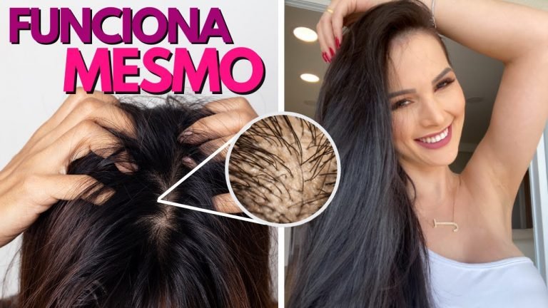 Leia mais sobre o artigo 9 Dicas para Acabar a Oleosidade do Cabelo! (comprovado) Funciona Mesmo 😲