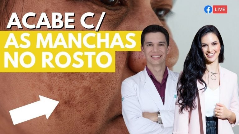 Leia mais sobre o artigo Acabe Com as Manchas na Pele, Inclusive Melasma – Receita Caseira 😘✨